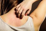 woman-scratching-her-neck
