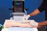 Ultrasound fundamentals