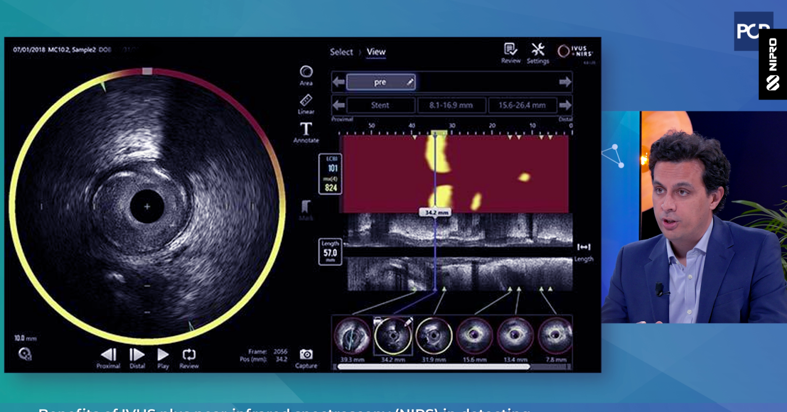 EuroPCR2025_Benefits_of_IVUS